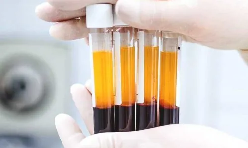 Liberação pelo CFM do Plasma Rico em Plaquetas representa avanço na Medicina Regenerativa, avalia ortopedista do Imot